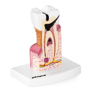 Model anatomiczny chorego zęba człowieka w skali 6:1 6 Model anatomiczny chorego zęba człowieka w skali 6:1 - obrazek 2