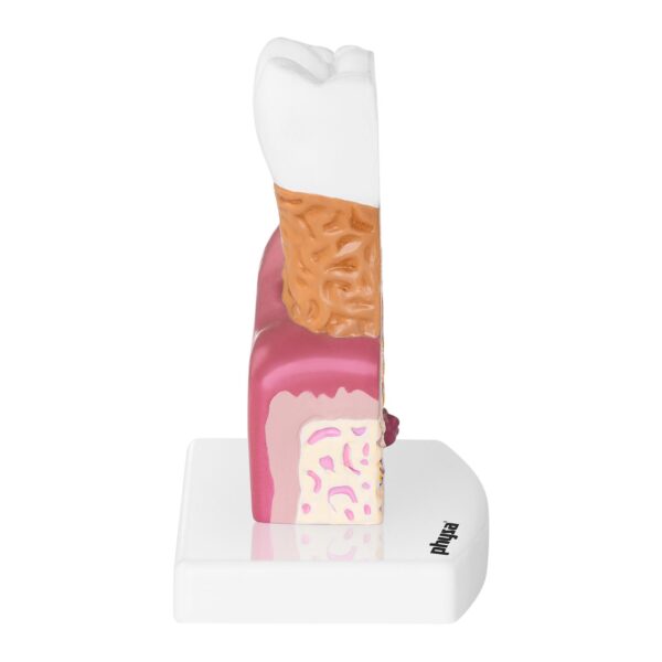 Model anatomiczny chorego zęba człowieka w skali 6:1 3 10040250 3