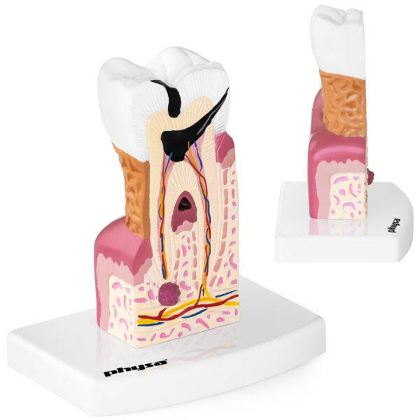 10040250-model-anatomiczny-chorego-zeba-czlowieka-w-skali-hurtownia-sklep 10040250 model anatomiczny chorego zeba czlowieka w skali hurtownia sklep