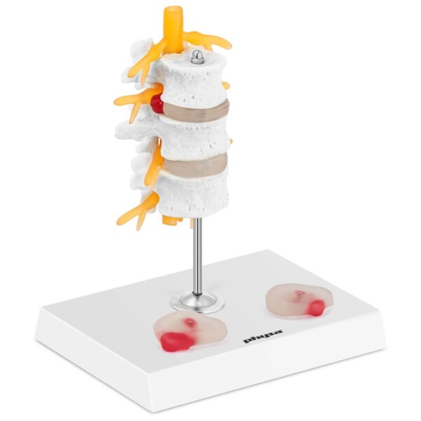 Model anatomiczny 3D odcinka lędźwiowego kręgosłupa z przepukliną kręgi 3-5 1 10040324 1