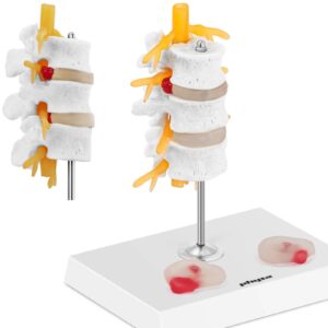 Model anatomiczny 3D odcinka lędźwiowego kręgosłupa z przepukliną kręgi 3-5 4 Model anatomiczny 3D odcinka lędźwiowego kręgosłupa z przepukliną kręgi 3-5 - obrazek 1
