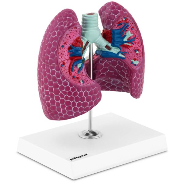 Model anatomiczny 3D płuca człowieka ze zmianami chorobowymi 1 10040329 1