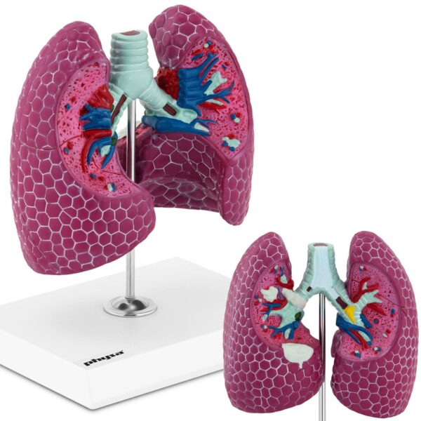 10040329-model-anatomiczny-3d-pluca-czlowieka-ze-zmianami-chorobowymi-hurtownia-sklep 10040329 model anatomiczny 3d pluca czlowieka ze zmianami chorobowymi hurtownia sklep